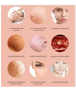 BeautyRelax Beauty Relax Peelmax - Cosmetic device for skin abrasion