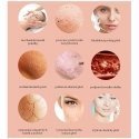 BeautyRelax Beauty Relax Peelmax - Cosmetic device for skin abrasion BeautyRelax Beauty Relax Peelmax - Cosmetic device for skin abrasion