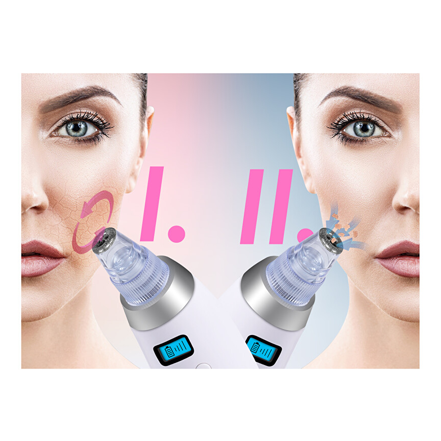 BeautyRelax Beauty Relax Peelmax - Cosmetic device for skin abrasion – 5