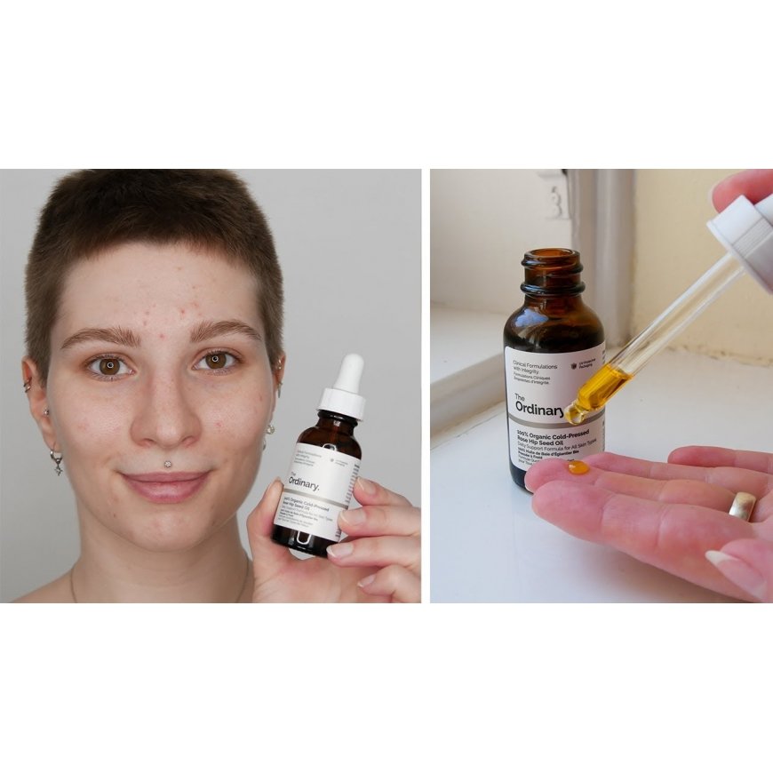 The Ordinary 100% Organic Rose Hip Seed Oil 30 – 2