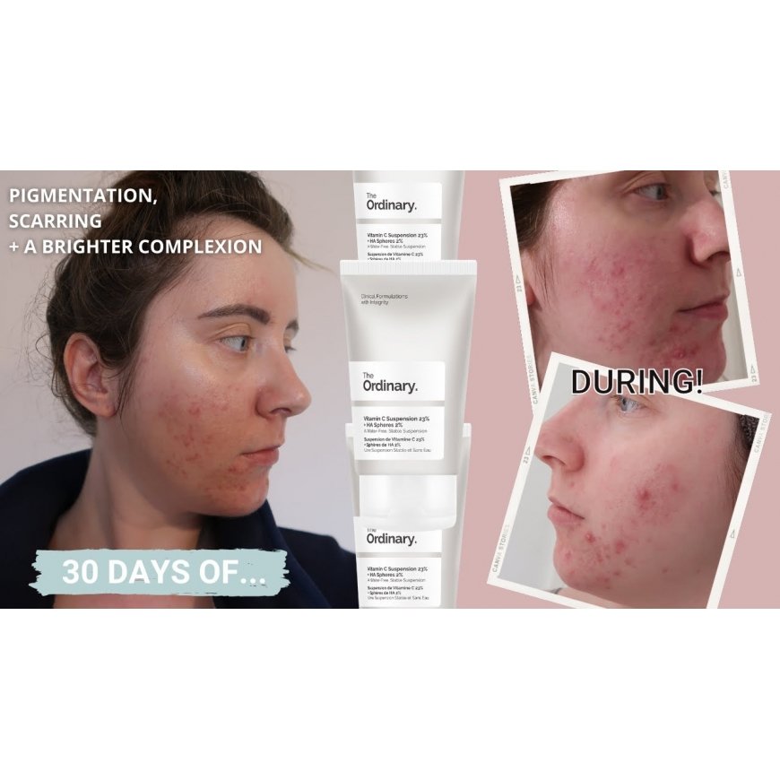 The Ordinary Vitamin C Suspension 23% + HA Spheres 2% 30 – 2