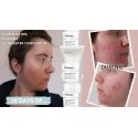 The Ordinary Vitamin C Suspension 23% + HA Spheres 2% 30 The Ordinary Vitamin C Suspension 23% + HA Spheres 2% 30