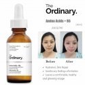 The Ordinary Amino Acids + B5 30 The Ordinary Amino Acids + B5 30