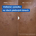 Mixa Niacinamide Bright Moisturizing Anti-Dark Spot Cream Body Cream Mixa Niacinamide Bright Moisturizing Anti-Dark Spot Cream Body Cream