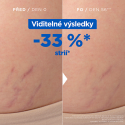 Mixa stretch mark oil against cellulite and stretch marks Mixa stretch mark oil against cellulite and stretch marks