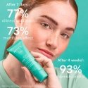 Apivita JUST BEE CLEAR Anti-Imperfections mattapintainen kosteuttava geelivoide rasvaiselle iholle 40 ml