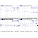 Mikrotik ACMMCXRPSMA коаксиальный кабель 0,26 m MMCX RPSMA Разноцветный Mikrotik ACMMCXRPSMA коаксиальный кабель 0,26 m MMCX RPSMA Разноцветный