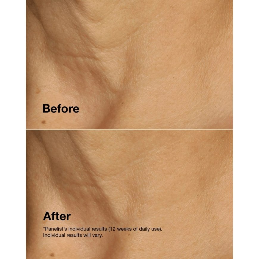 Clinique Smart Clinical Repair™ Lifting Face + Neck Cream 50ml – 5