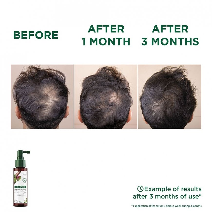 Klorane With quinine and organic edelweiss anti-hair loss serum 100 ml