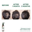 Klorane With quinine and organic edelweiss anti-hair loss serum 100 ml