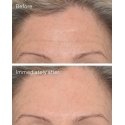 Murad Targeted Wrinkle Corrector 15ml Murad Targeted Wrinkle Corrector 15ml
