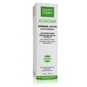 MartiDerm Acniover 40 ml Želeja Caurule MartiDerm Acniover 40 ml Želeja Caurule