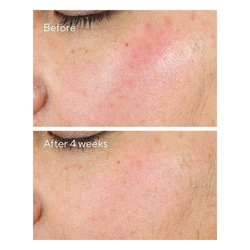 Murad 15293 Sejas dienas un nakts krēms All ages 50 ml – 4