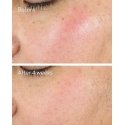 Murad 15293 Veido dieninis arba naktinis kremas Dieninis ir naktinis kremas All ages 50 ml