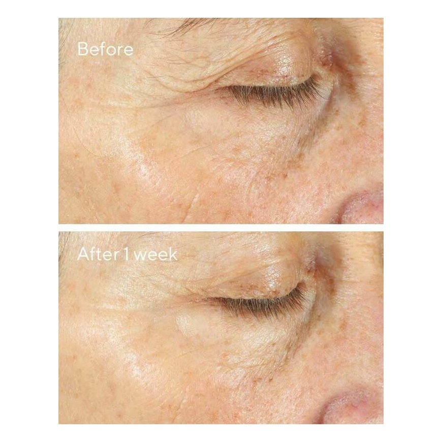 Murad Intense Recovery Cream 50 ml – 5