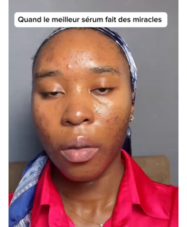 Anua Heartleaf 80% Raminantis Ampulė