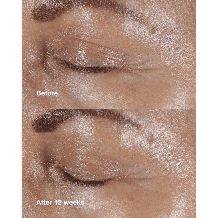 Clinique Smart Clinical Repair Wrinkle Correcting Eye Cream 15 ml – 4