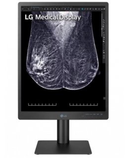 LG 21,3'' 3MP IPS DIAGNOSTINIS MONITORIUS