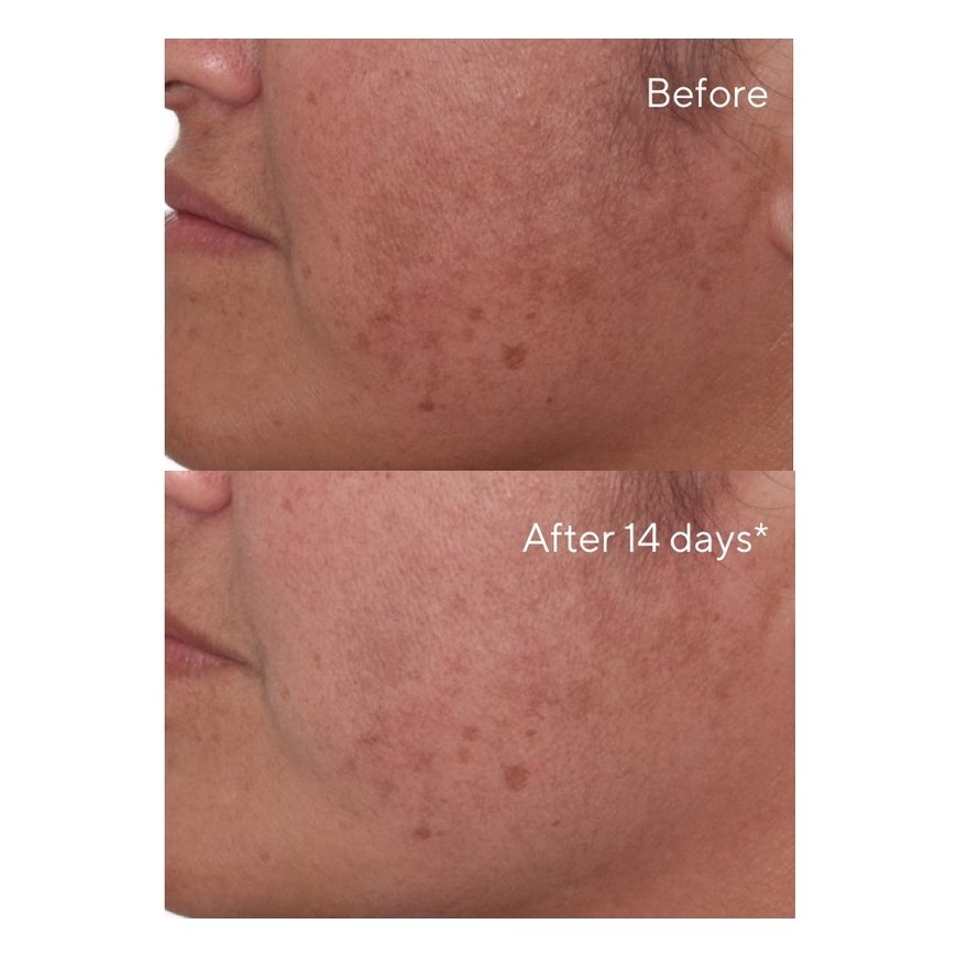 Murad Rapid Dark Spot Correcting Serum 30ml – 3