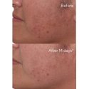 Murad 15348 Veido serumas arba koncentratas 30 ml Moteriškas