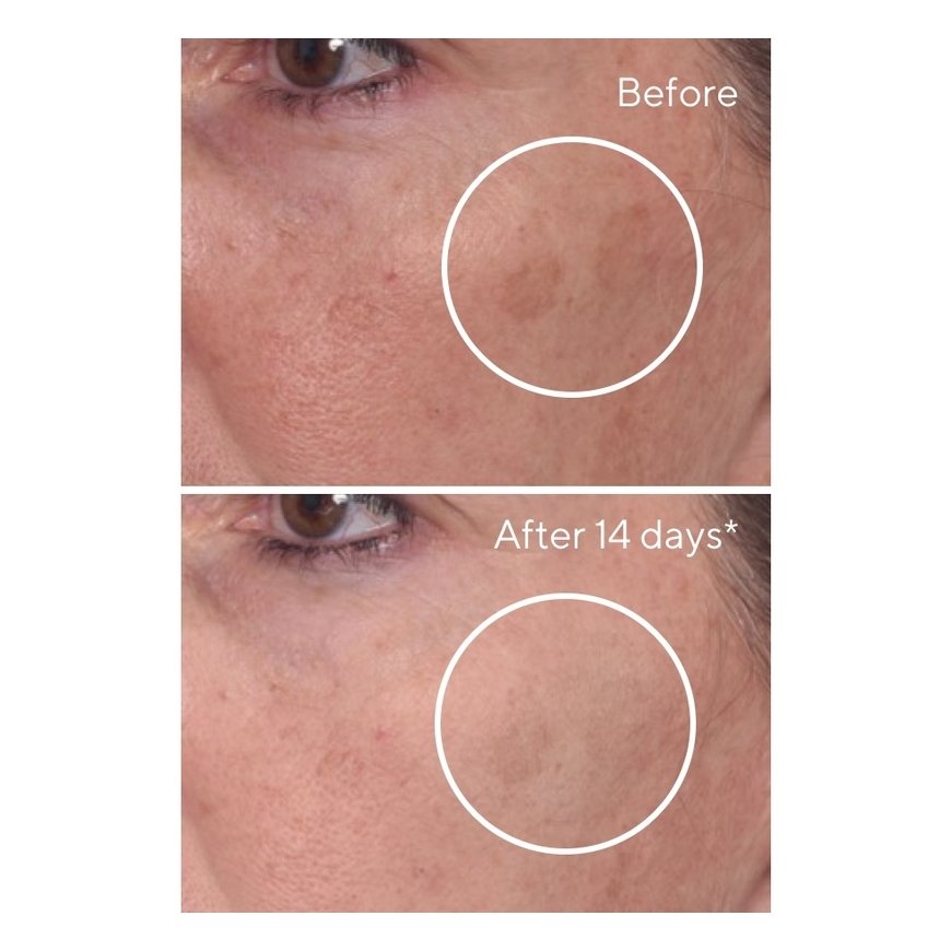 Murad 15348 Näoseerum või -kontsentraat 30 ml Naised – 4