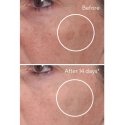 Murad 15348 Sejas serums un koncentrāts 30 ml Sievietes Murad 15348 Sejas serums un koncentrāts 30 ml Sievietes