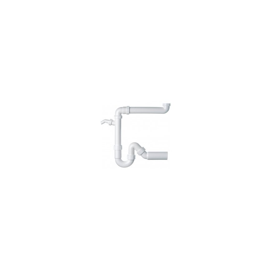 Franke Sink S2D 651 Carbon – 2