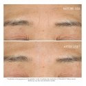 Dior Capture Totale Hyalushot 15 ml Sievietes Dior Capture Totale Hyalushot 15 ml Sievietes