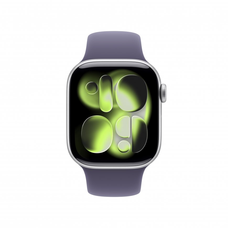 Apple Watch Series 11 – 2