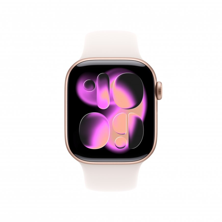 Apple Watch Series 11 – 2