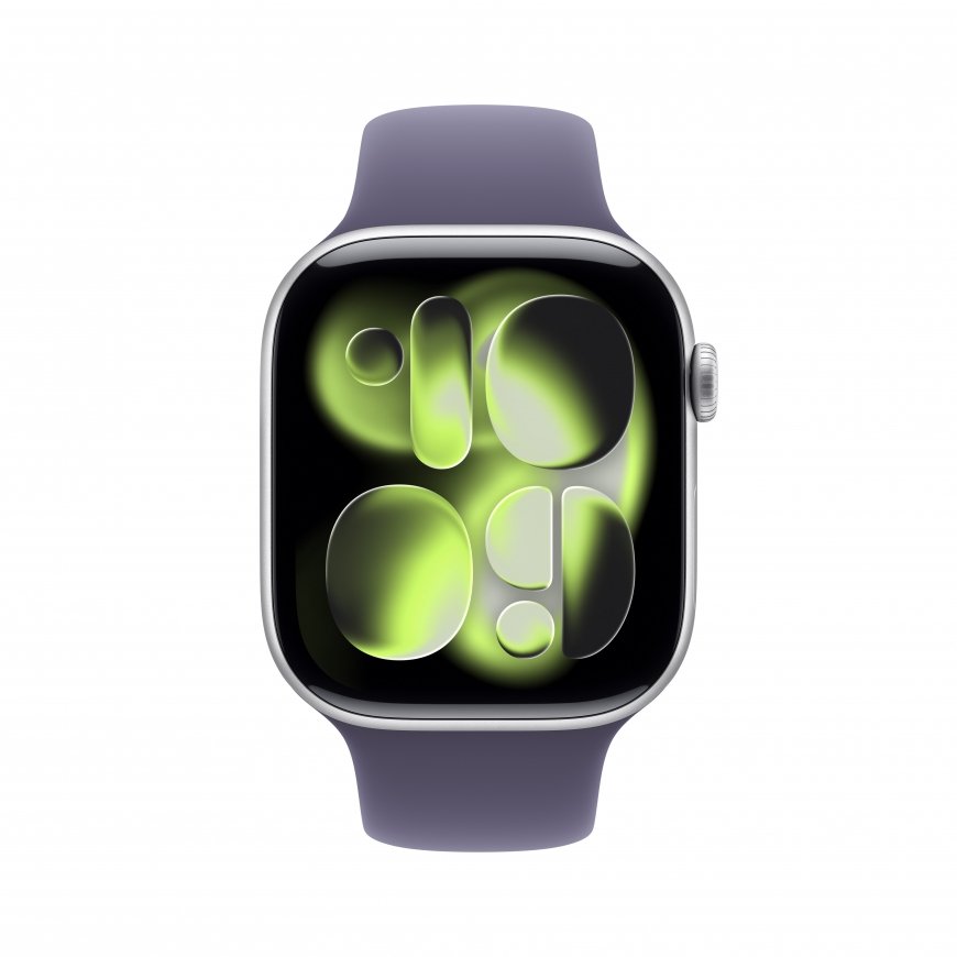 Apple Watch Series 11 – 2