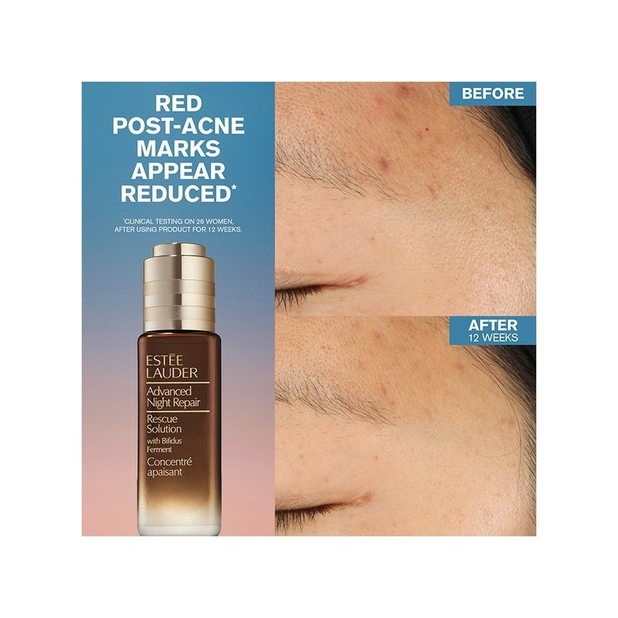 Estée Lauder Advanced Night Repair Rescue Solution Serum with 15% Bifidus Ferment 20ml – 3