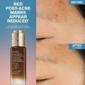 Estée Lauder Advanced Night Repair Rescue Solution Serum with 15% Bifidus Ferment 20ml