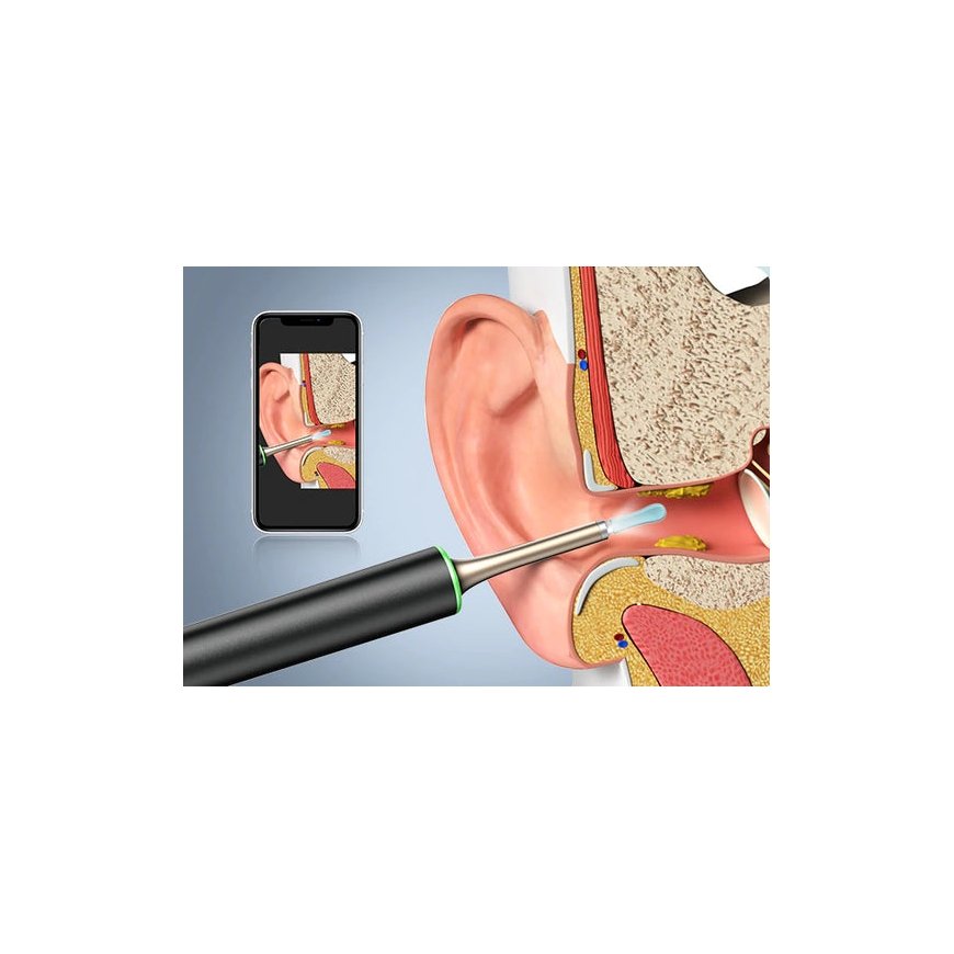 Bebird T15 1 pc(s) – 4