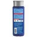 "Naturvital" šampūnas nuo plaukų slinkimo jautriai galvos odai, 300 ml "Naturvital" šampūnas nuo plaukų slinkimo jautriai galvos odai, 300 ml