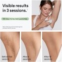 Braun IPL Silk·expert Mini PL1114 IPL ierīce Braun IPL Silk·expert Mini PL1114 IPL ierīce
