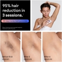 Braun Smart IPL Skin i·expert PL7431 IPL-laite Braun Smart IPL Skin i·expert PL7431 IPL-laite