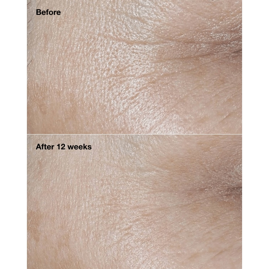Clinique Smart Clinical Repair näonaha niisutaja Naised 50 ml Pasta – 4