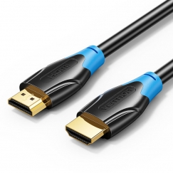 Vention AACBN HDMI-kaapeli 15 m HDMI-tyyppi A (vakio) Musta