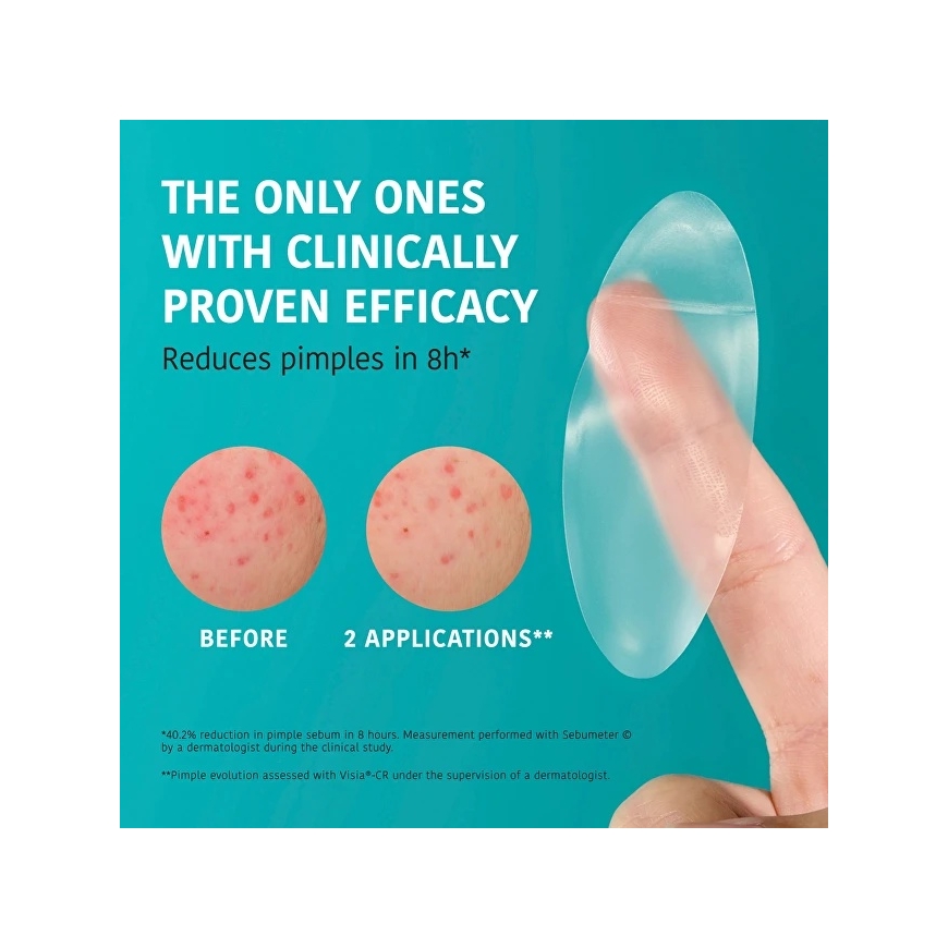Iroha ACNE PRONE SKIN hidrokoloidinės pleistrys XL 5 vnt. – 5