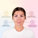LED-kasvomaski Perfect Skin MO8303 CONCEPT LED-kasvomaski Perfect Skin MO8303 CONCEPT