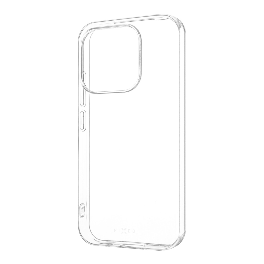Fixed Story AntiUV | Tagakaas | Xiaomi | 17 | TPU | – 2