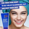Clean & Clear Peeling Gel for Blackheads 150ml Clean & Clear Peeling Gel for Blackheads 150ml
