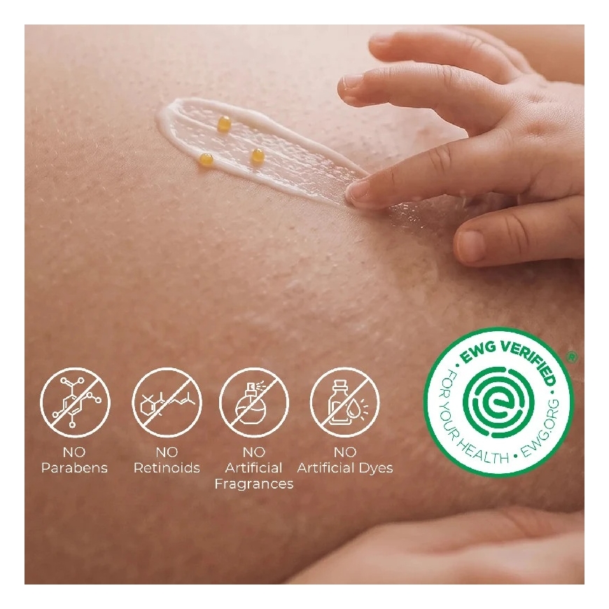 MOMCOZY STANGRINAMASIS KŪNO KREMAS NUO STRIJŲ SU KOLAGENU, 30 G – 2