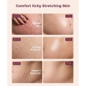 MOMCOZY STRIAE-RELIEVING BODY CREAM WITH COLLAGEN, 30 G