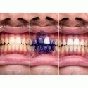 Hismile V34 Tooth Colour Correcting Serum 30 ml Hismile V34 Tooth Colour Correcting Serum 30 ml