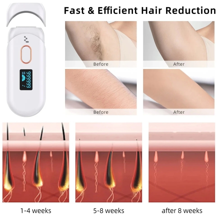 IPL Hair Removal Device Reach IPL-1 – 3