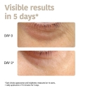 Iroha Nature Sheet Eye Patches, with niacinamide, caffeine, and peptides, 2 pcs. Iroha Nature Sheet Eye Patches, with niacinamide, caffeine, and peptides, 2 pcs.