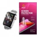 iLike Ремешок Apple Watch 38mm Sport Band (S/M&M/L) Yellow iLike Ремешок Apple Watch 38mm Sport Band (S/M&M/L) Yellow