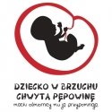Hencz Contrasting toy Mini Octopus ZA3667 Hencz Contrasting toy Mini Octopus ZA3667